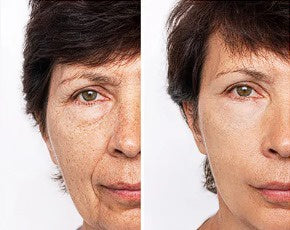 Cremă Minune cu Venin de Albine