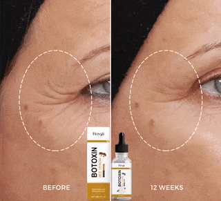 Cremă Minune cu Venin de Albine